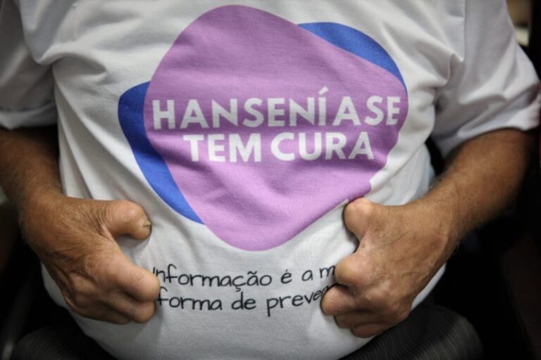 Acre intensifica ações contra a hanseníase durante Janeiro Roxo